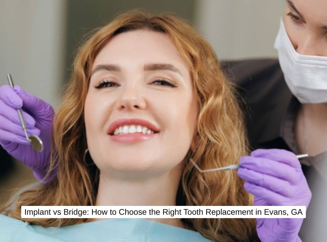 Implant vs Bridge How to Choose the Right Tooth Replacement in Evans, GA