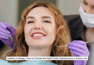 Implant vs Bridge How to Choose the Right Tooth Replacement in Evans, GA